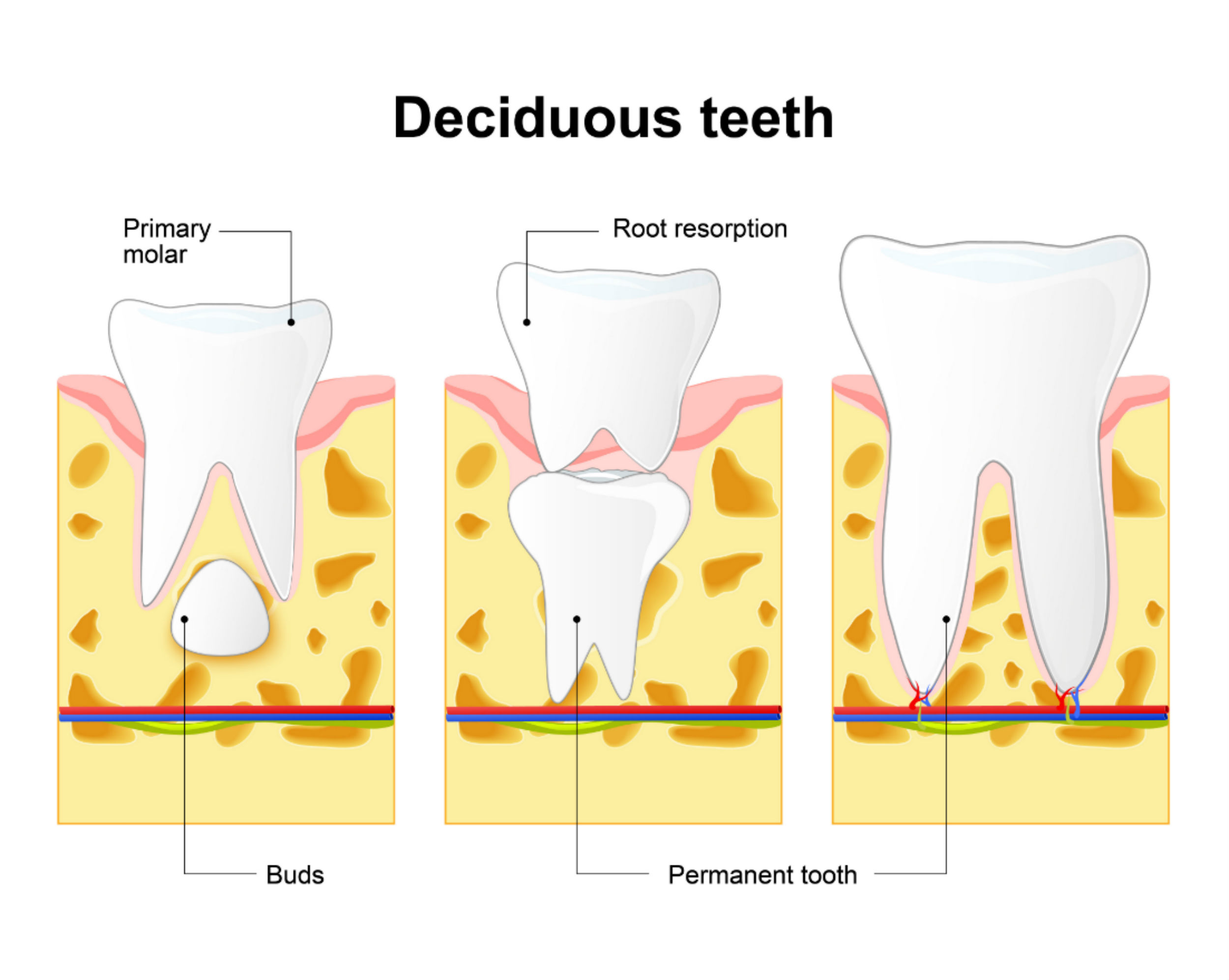 Root Resorption after Root Canal Beverly Hills Root Resorption Treatment